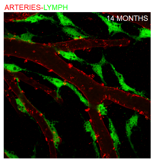 Brain-Lymphatic Endothelial Cells