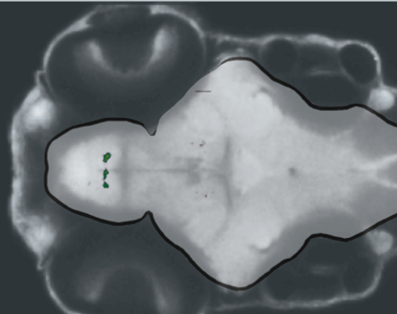 Galanin neurons in the preoptic area