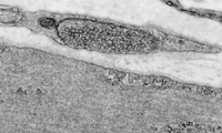 TEM, perivascular autonomic nerve varicosity