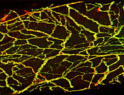 Perivascular nerves of mesenteric artery.