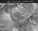 SEM image of bacterial biofilm