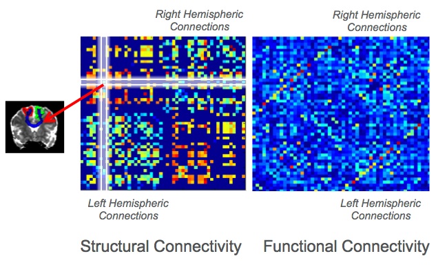 whole brain connectivity matrix