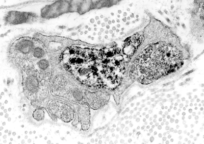 Large EM image of human cerebrovascular nerves producing nitric oxide