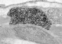 TEM, perivascular axon varicosity, showing NPY