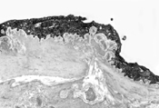 ET-1 in cerebrovascular endothelium.