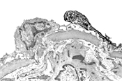 Substance P in cerebrovascular endothelium.