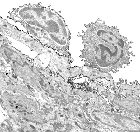 Larger version leukocytes adhering to regenerated endothelium