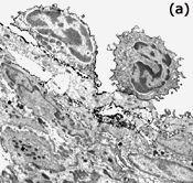 Leukocytes adhere to endothelium