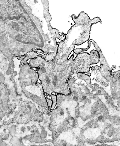 Larger version, leukocyte entering vascular wall