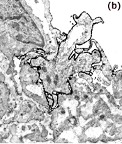 Leukocyte migrating through endothelial layter