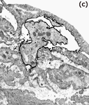 Endothelium overlaying leukocyte