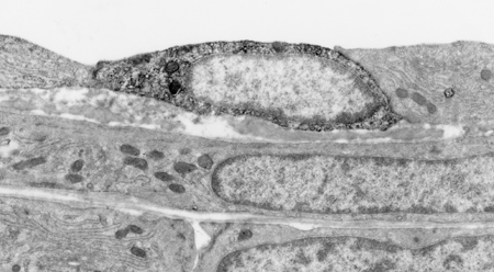 Large version, coronary AVP