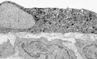 Figure 1. AVP-positive endothelial cell.