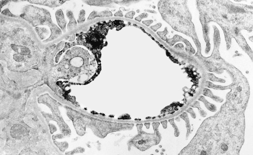 Large version, renal glomerular capillary