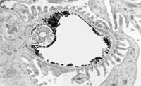 Figure 4. Renal glomerular capillary with nitric oxide