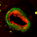 A small artery in the human brain, labelling for eNOS (red).