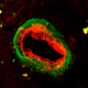 ENOS in endothelium of artery.