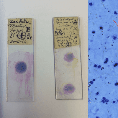 Ancient DNA as a toolkit to explore the past